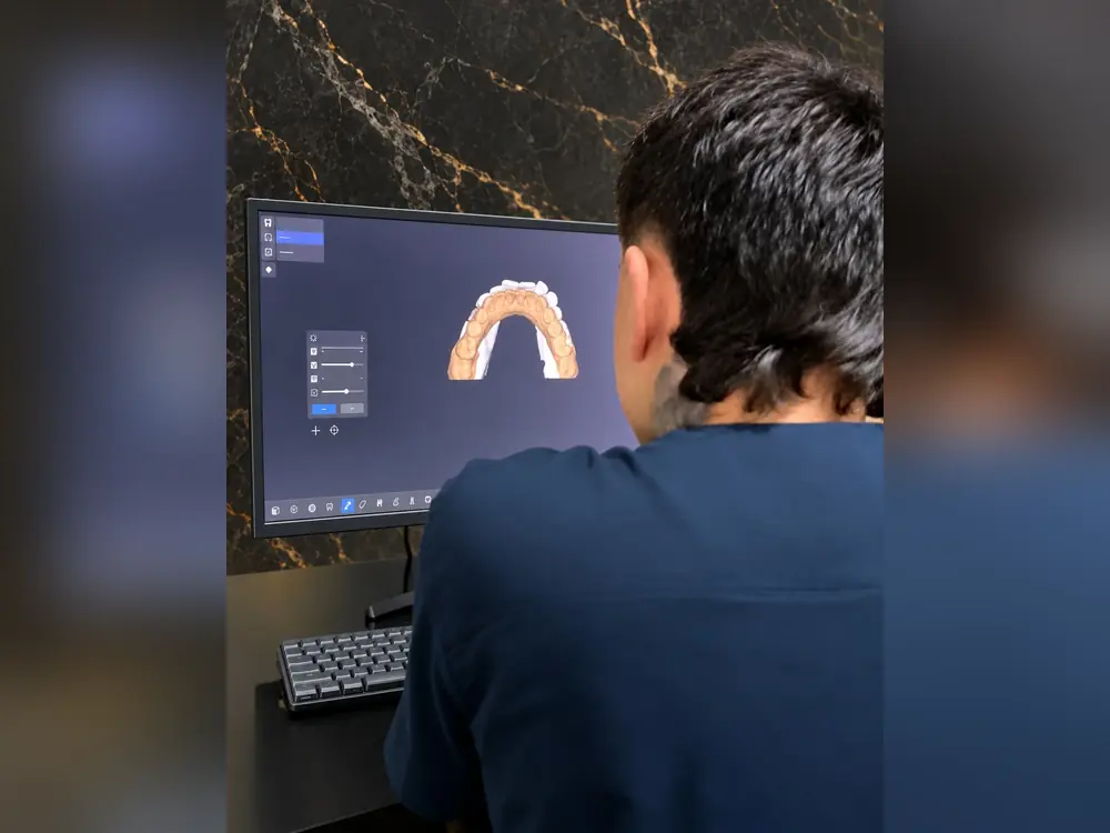 Technician designing a crown on a digital model of the teeth