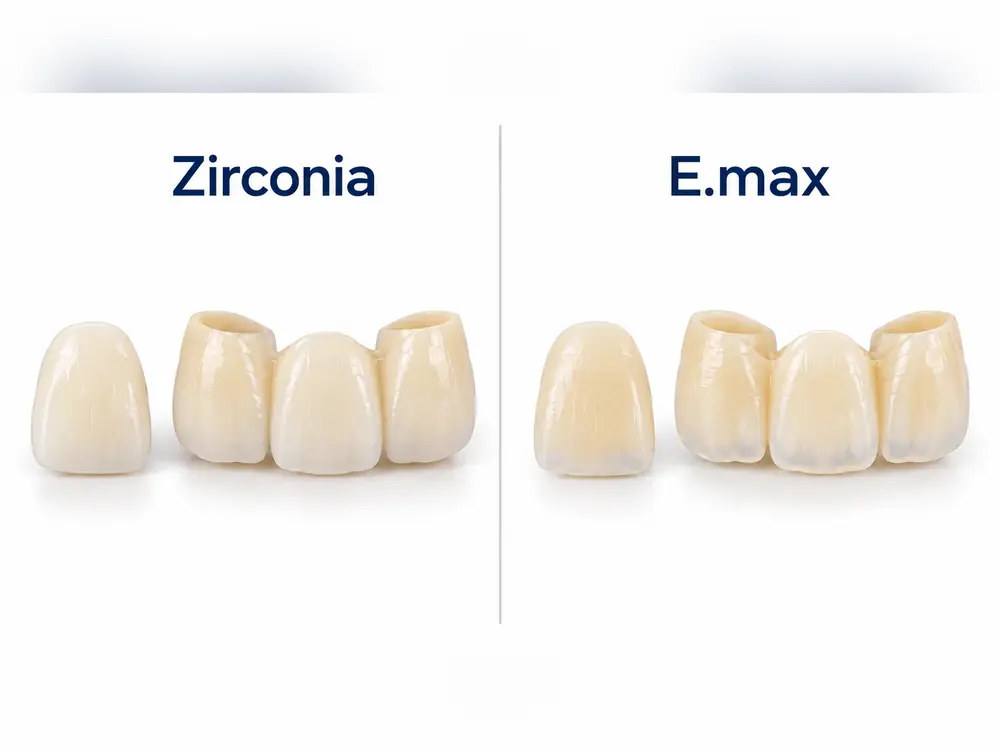 Finished zirconia and E.max crowns and bridges made in-house at Esthetic Dent