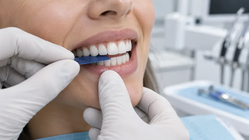 Dentist checking the fit and shade of new veneers