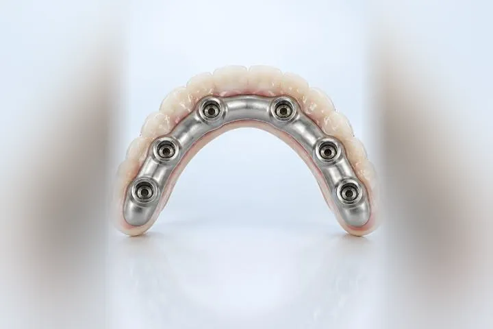 Zirconia fixed bridge material at Esthetic Dent
