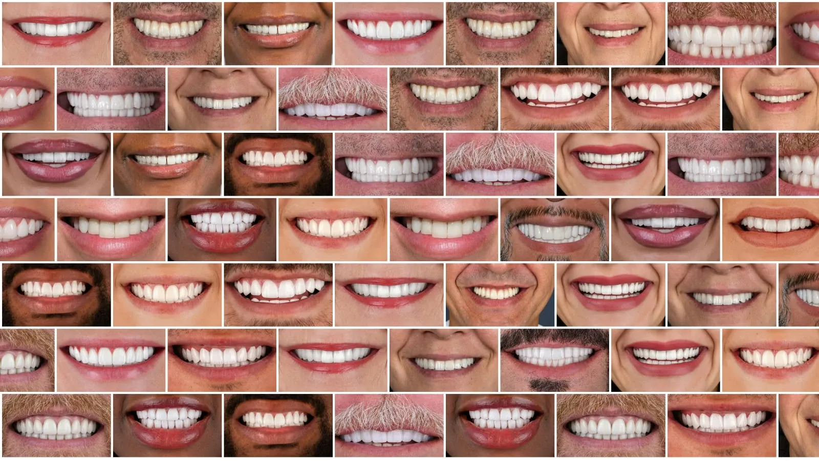 Mosaico de sonrisas reales de pacientes tratados en Esthetic Dent